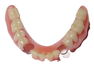 частичный акриловый протез